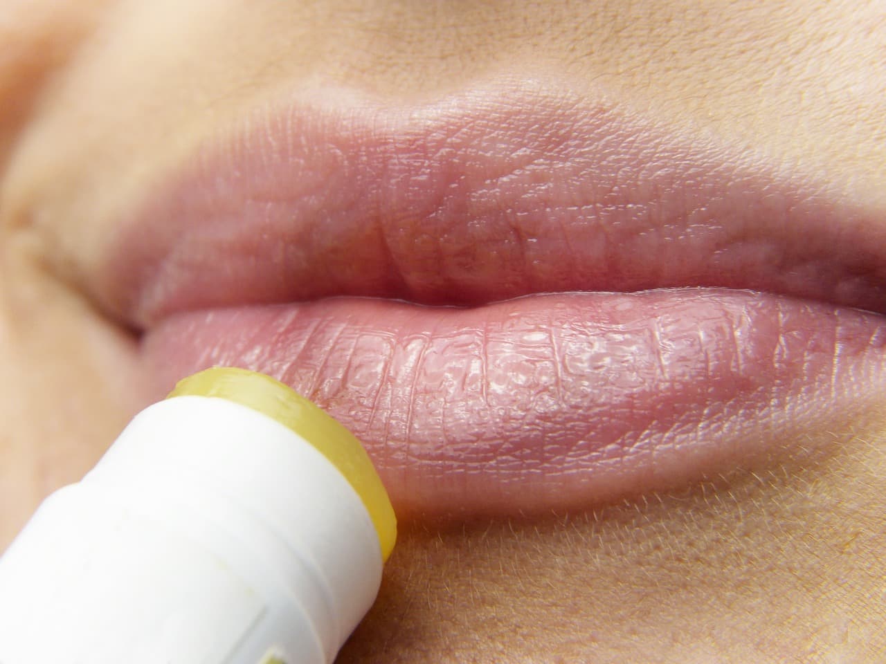 Best lip care products for dry chapped and pigmented lips